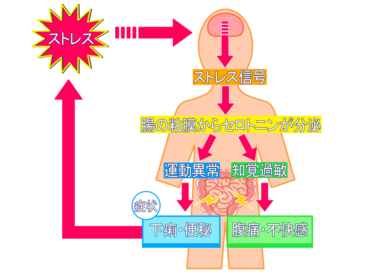 過敏性腸症候群の原因